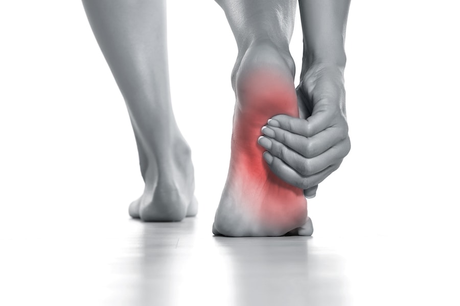 Chronic Heel Spur: Efficacy of Shockwave Therapy in Treating Chronic Plantar Fasciitis